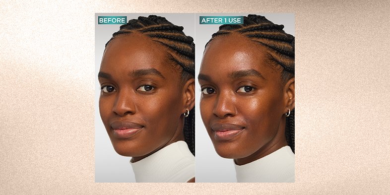 In Article How To Prevent Sun Spots 3